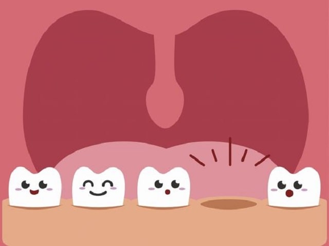 Ngủ mơ thấy rụng răng gãy răng là tốt hay xấu? Nên đánh con gì?